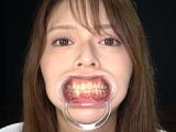 人気女優の激レアな歯・治療跡・のどちんこ観察！